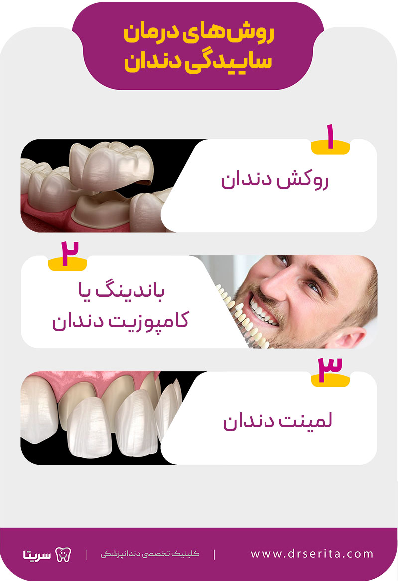 روش های درمان ساییدگی دندان