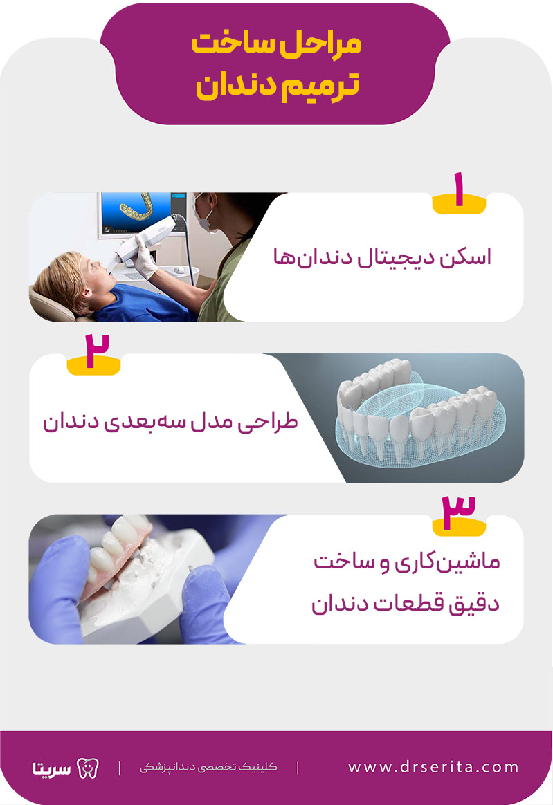 مراحل ساخت ترمیم دندان