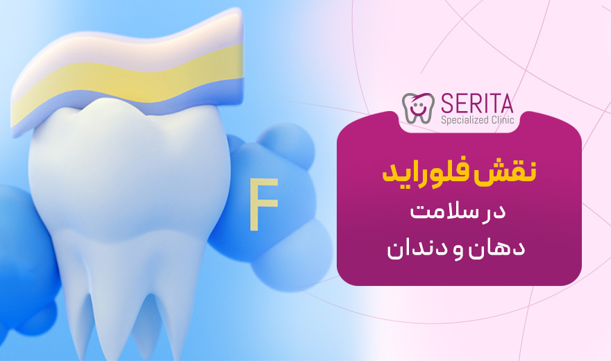 نقش فلوراید در سلامت دهان و دندان