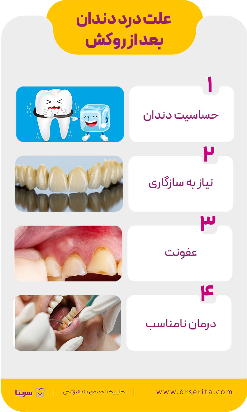 علت درد دندان بعد از روکش