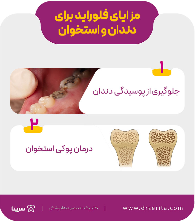 مزایای فلوراید برای دندان و استخوان