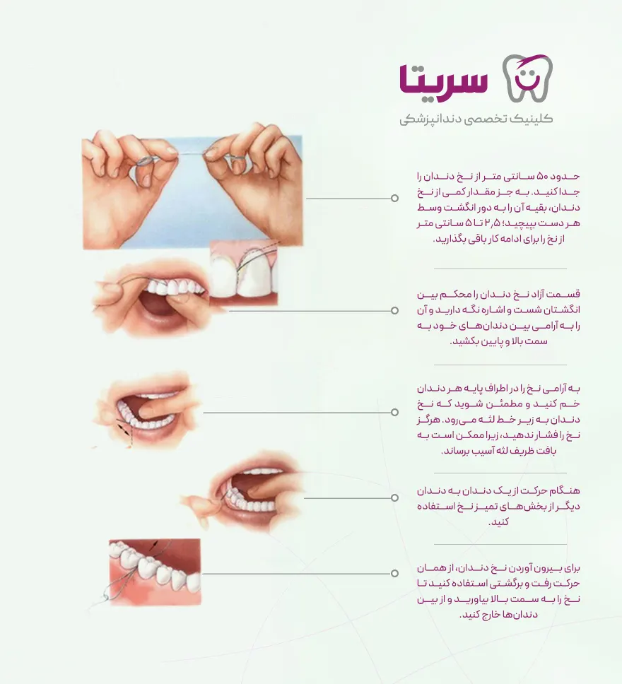 روش صحیح کشیدن نخ دندان