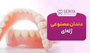 دندان مصنوعی ژله‌ای چیست؟