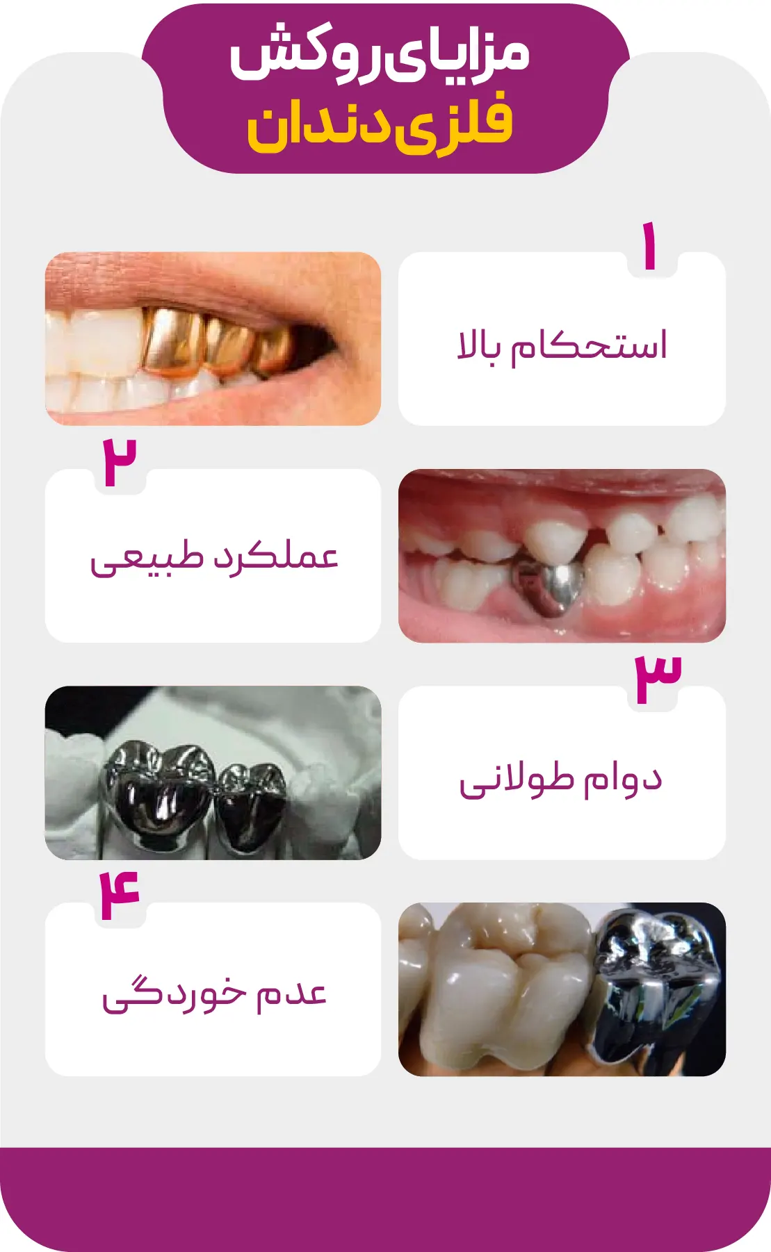 مزایای روکش فلزی دندان