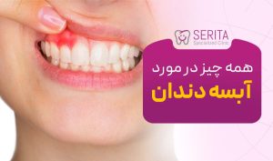 علائم و راه‌های درمان آبسه دندان