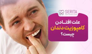 علت افتادن کامپوزیت دندان چیست؟