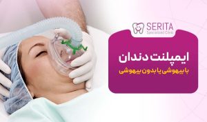 ایمپلنت دندان با بیهوشی یا بدون بیهوشی