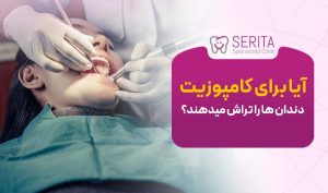 آیا برای کامپوزیت دندان ها را تراش میدهند؟