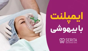 ایمپلنت دندان با بیهوشی | مزایا، ریسک‌ها و هزینه تقریبی
