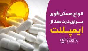 انواع مسکن قوی برای درد بعد از ایمپلنت و دستور استفاده