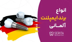 انواع برند ایمپلنت آلمانی + قیمت و مزایا