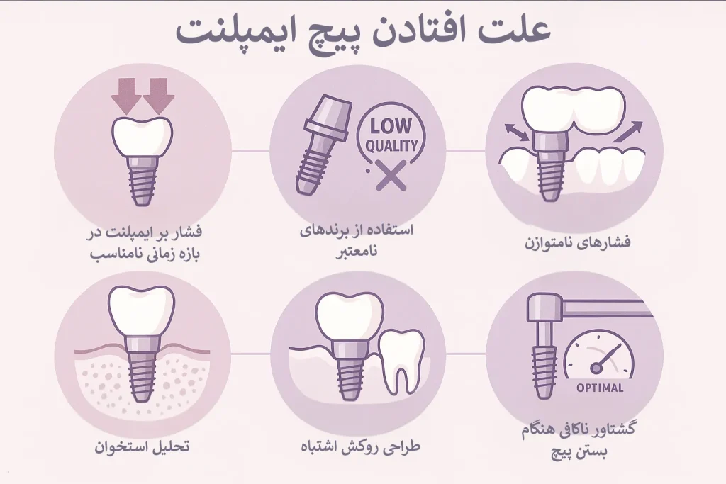 علت‌های اصلی افتادن پیچ ایمپلنت