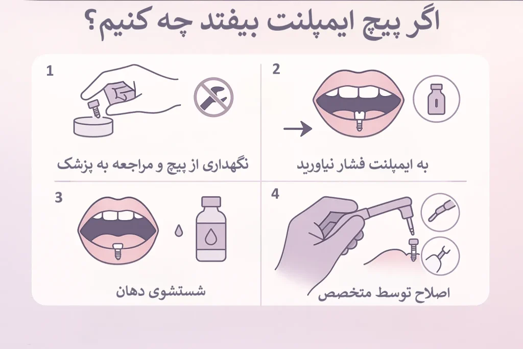 اگر پیچ ایمپلنت بیفتد چه کنیم؟