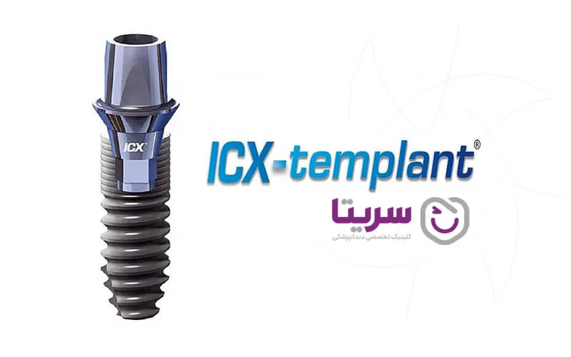 ایمپلنت آی‌سی‌ایکس (Icx)