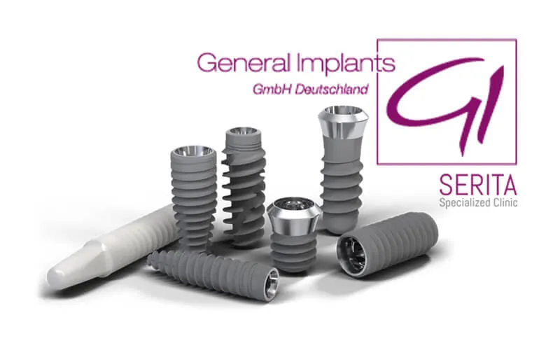 جنرال ایمپلنت (General)