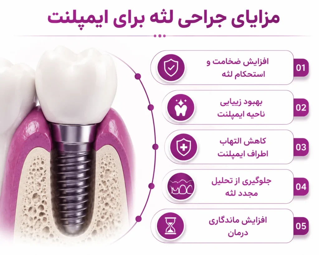 مزایای جراحی لثه برای ایمپلنت 