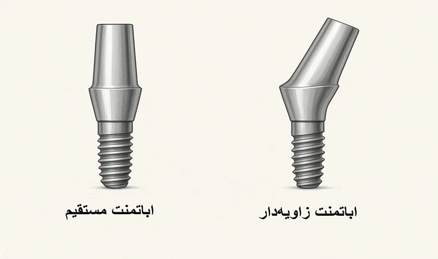 نمای ظاهری اباتمنت زاویه دار و مستقیم.