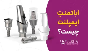 ="اباتمنت