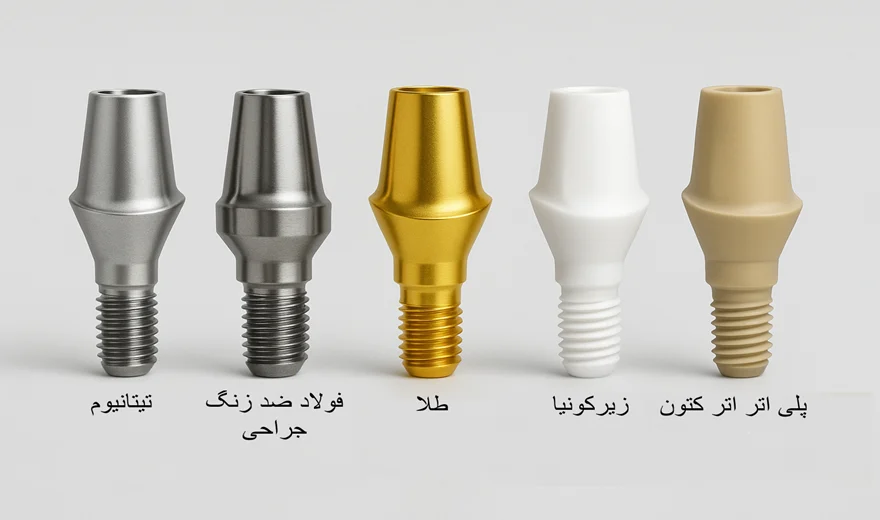 انواع اباتمنت براساس جنس ساخته شده.