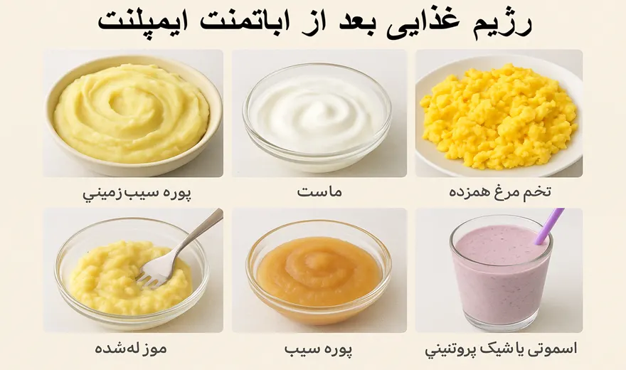 رژیم غذایی بعد از اباتمنت ایمپلنت.