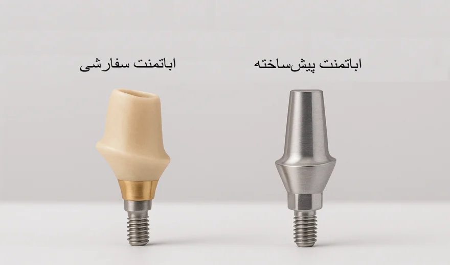 نمای ظاهری اباتمنت سفارشی و پیش ساخته.