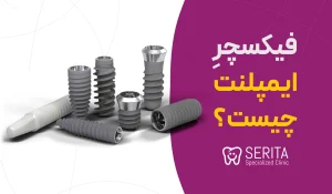 ="فیکسچر