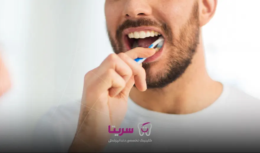 برای مراقبت از فیکسچر ایمپلنت دندان، باید مسواک زد.