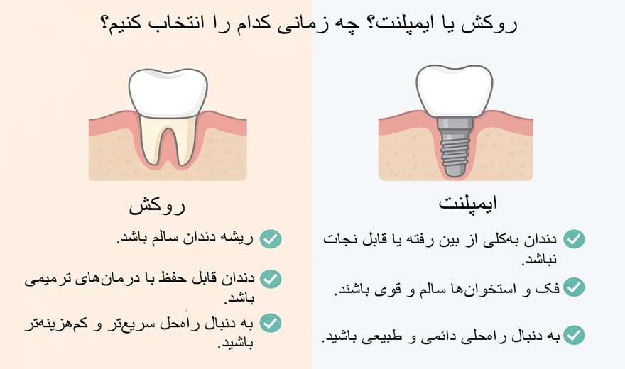 اینفوگرافیک ایمپلنت بهتر است یا روکش؟