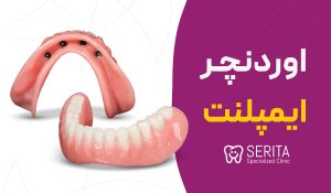 ="اوردنچر