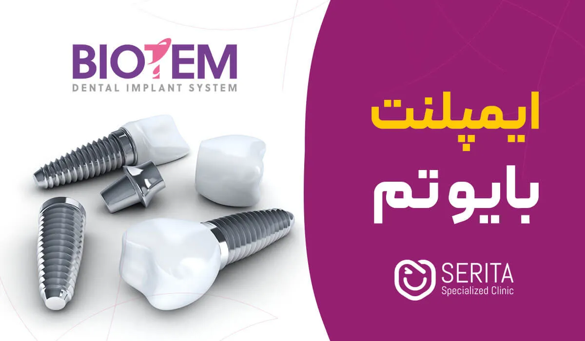 ایمپلنت بایوتم (Biotem) چیست؟ مقایسه، مزایا و معایب