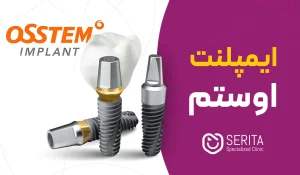 ="ایمپلنت