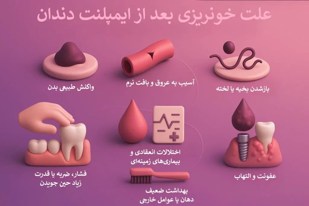 اینفوگرافیک علت خونریزی بعد از ایمپلنت دندان