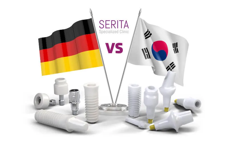 تفاوت ایمپلنت کرهای و آلمانی