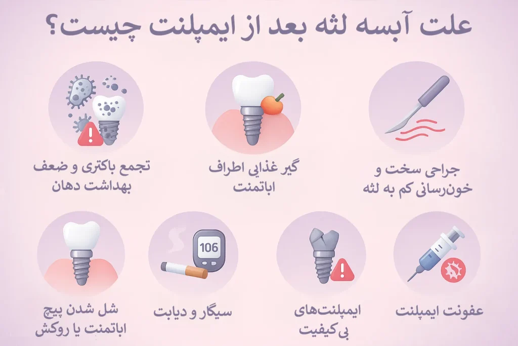 اینفوگرافیک علت آبسه لثه بعد از ایمپلنت چیست؟