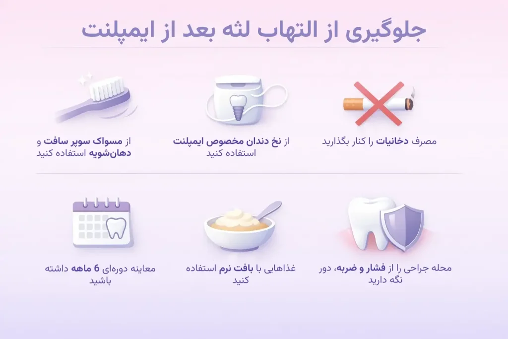 روشهای جلوگیری از التهاب لثه بعد از ایمپلنت