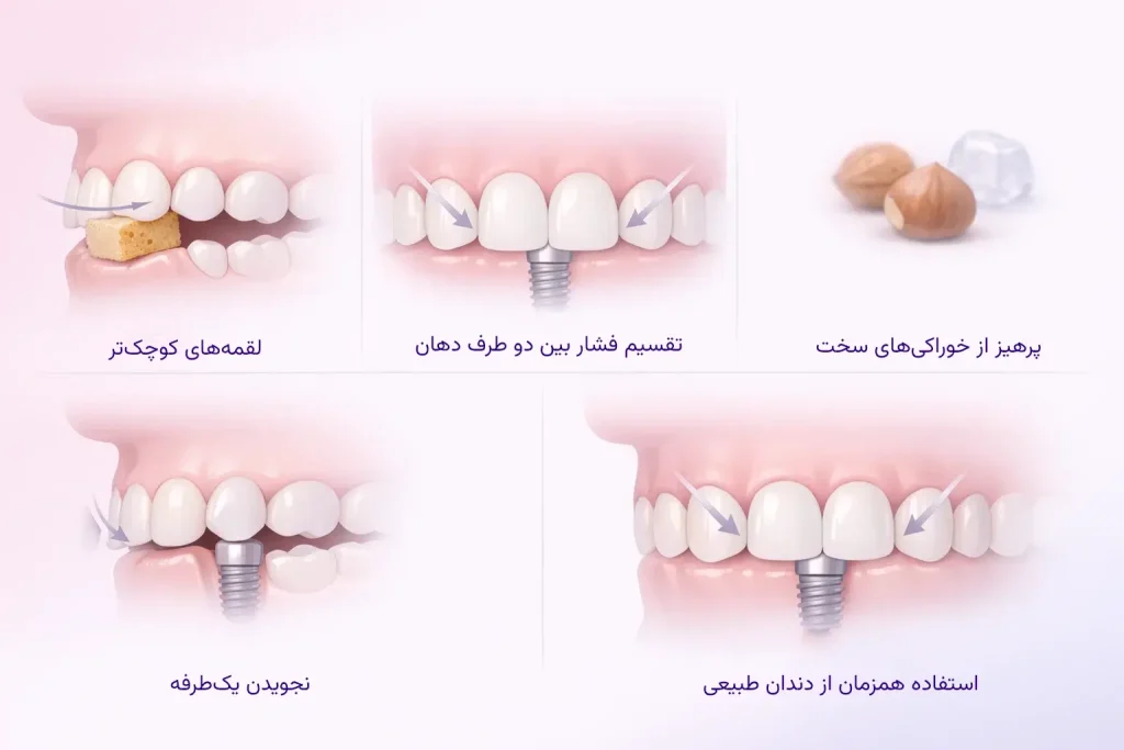 اینفوگرافیک تکنیک صحیح جویدن با دندان ایمپلنت