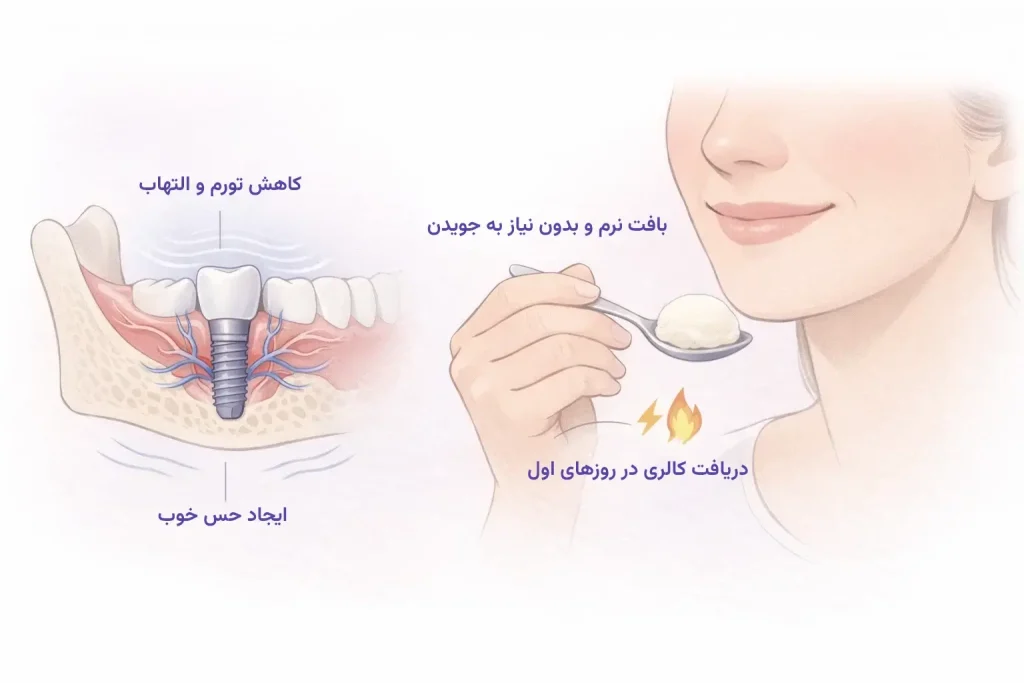 اینفوگرافیک چرا خوردن بستنی بعد از ایمپلنت مفید است؟