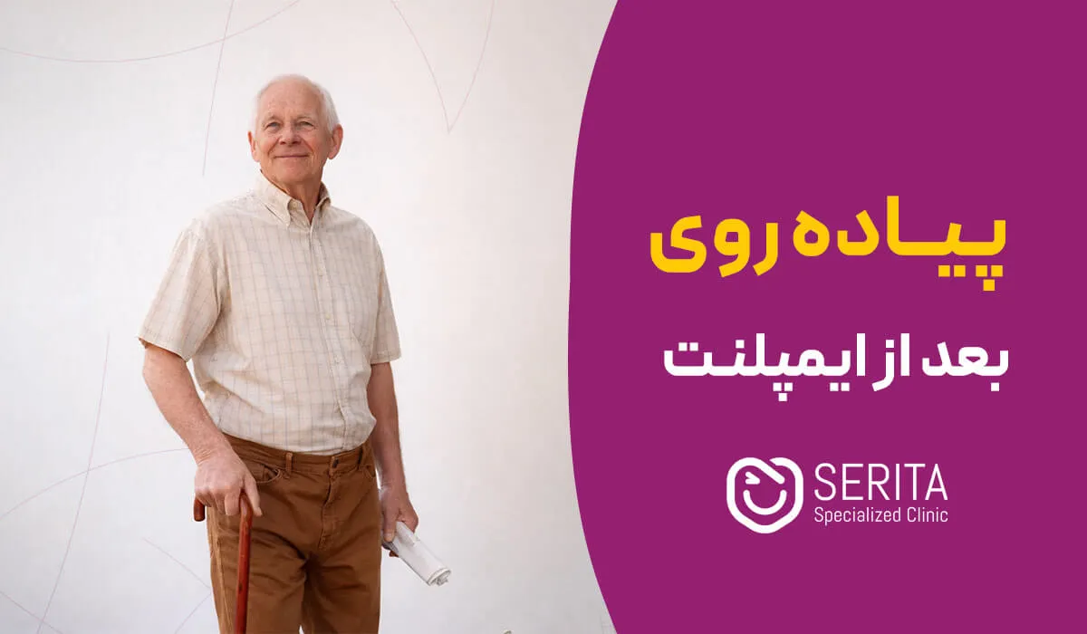 پیاده‌روی بعد از ایمپلنت دندان؛ از چه زمانی و با چه شدتی؟