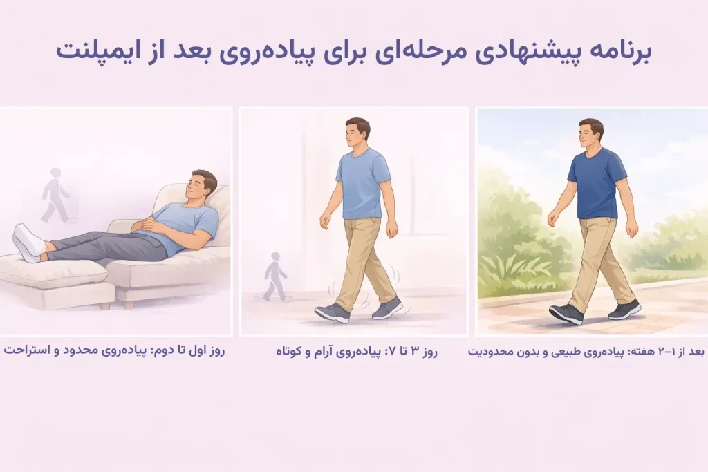 اینفوگرافیک برنامه پیشنهادی مرحلهای برای پیادهروی بعد از ایمپلنت