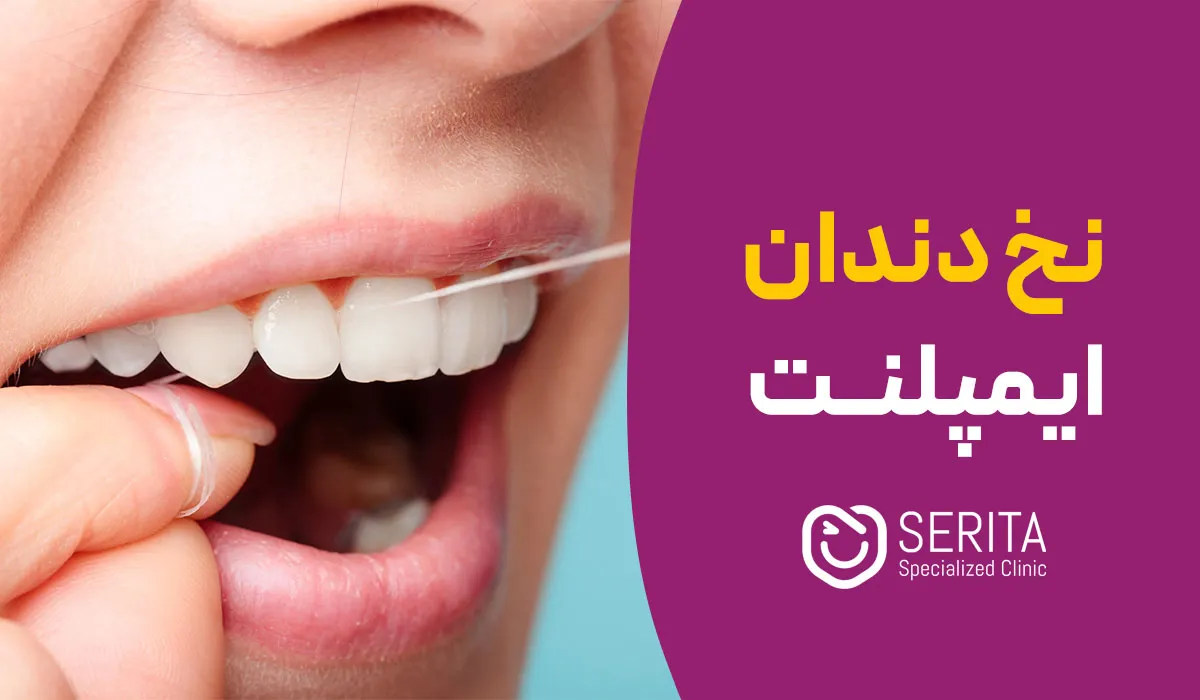 نخ دندان ایمپلنت