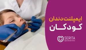 ایمپلنت دندان کودکان مجاز است؟ | سن مناسب + جایگزین ایمن