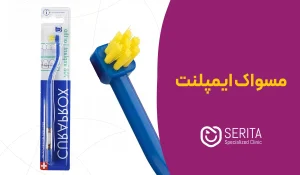 مسواک ایمپلنت | بهترین مسواک مخصوص ایمپلنت + طریقه مسواک‌زدن