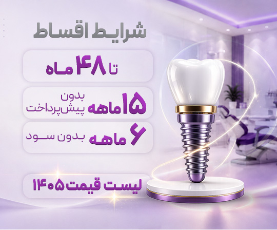 شرایط اقساط ایمپلنت