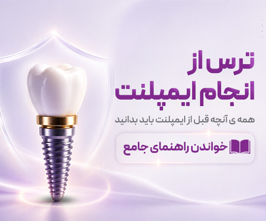ترس از انجام ایمپلنت