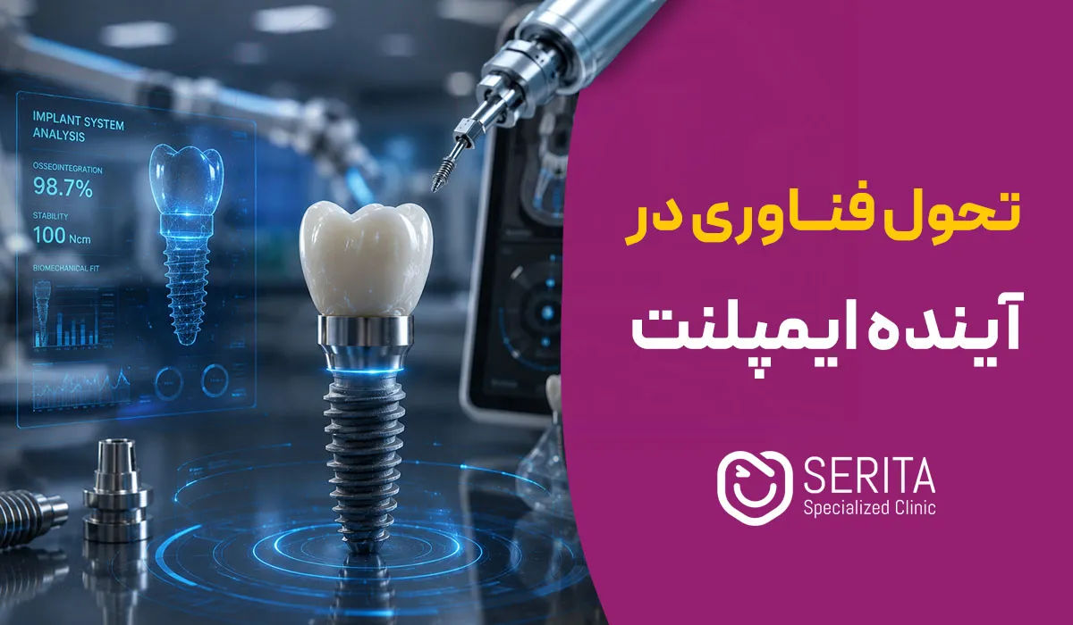 تحول بزرگ در ایمپلنت دندان؛ هوش مصنوعی و چاپ سه‌بعدی وارد میدان شدند!