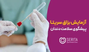 آزمایش بزاق سریتا، پیشگوی راز سلامت دندان‌ها!