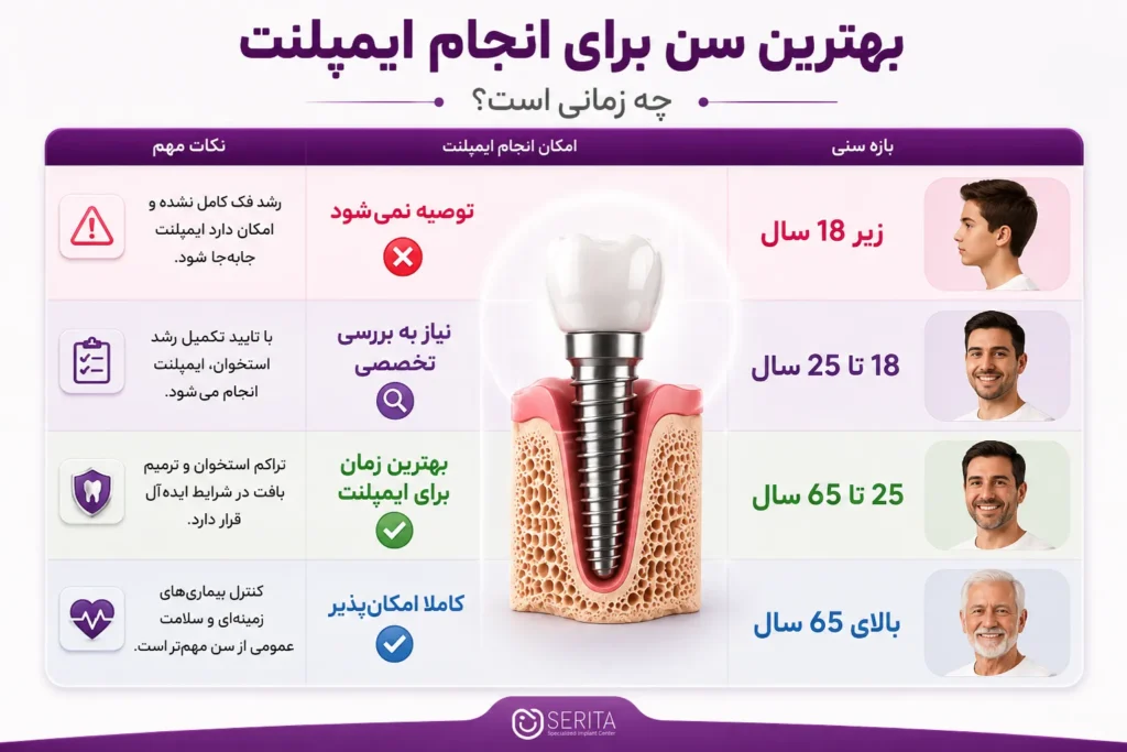 بهترین سن برای ایمپلنت دندان