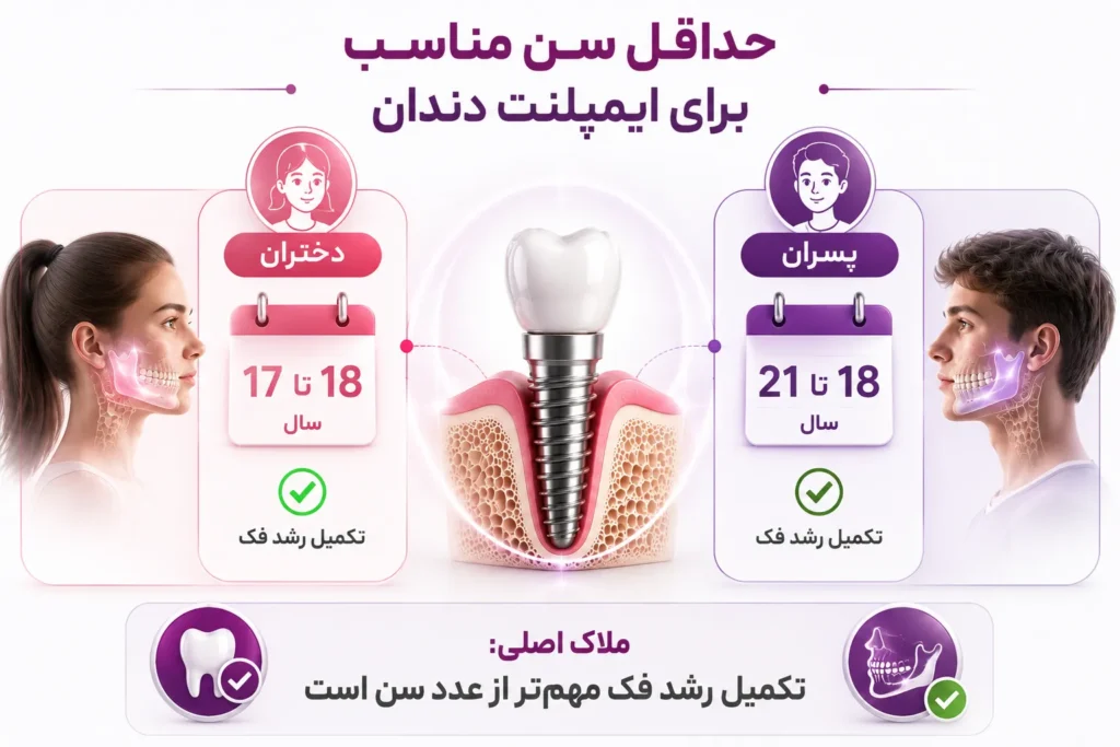 حداقل سن برای ایمپلنت دندان