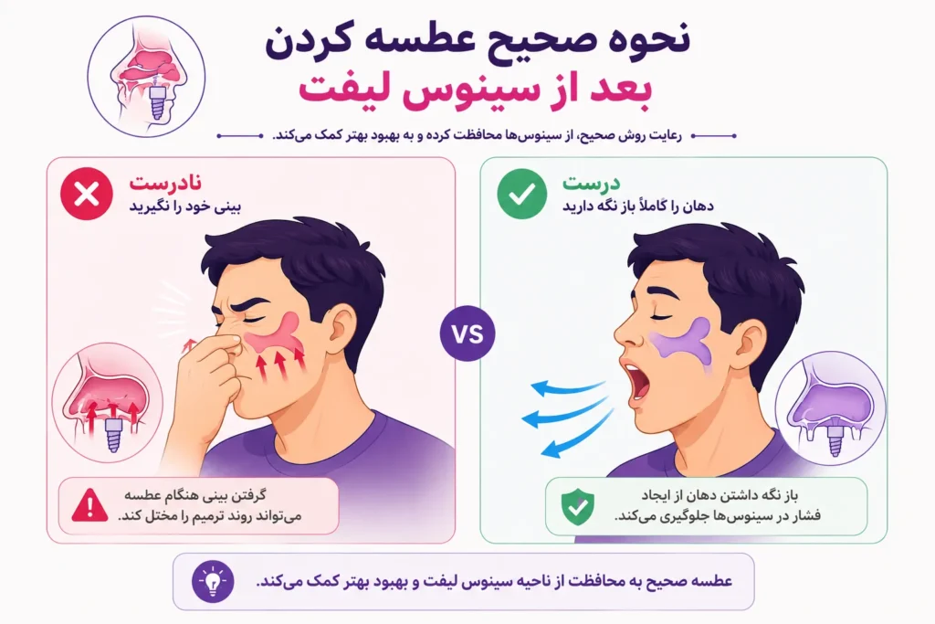 نحوه صحیح عطسه کردن بعد از جراحی سینوس لیفت