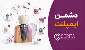 ۱۰ دشمن ایمپلنت دندان که ممکن است از آن‌ها بی‌خبر باشید!